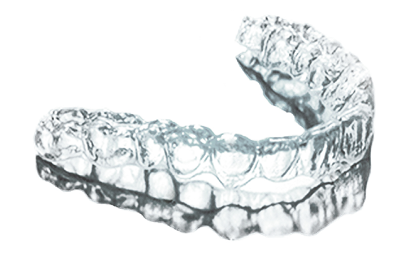 3D打印牙模 3D打印牙模